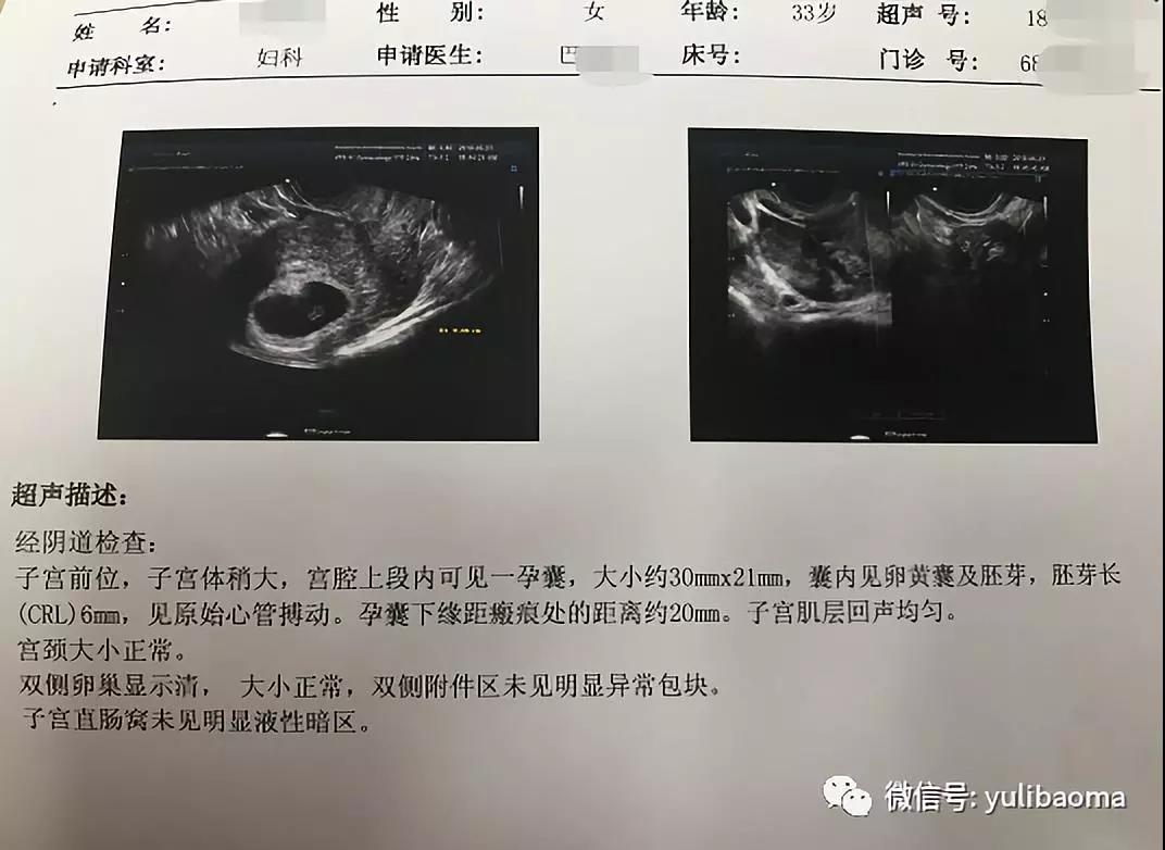 验血查男女的原理_验血查男女是什么原理(2)